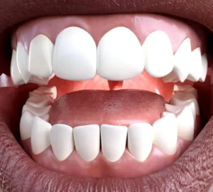 3D dental animation displayed on a clinic website screen for patient education and marketing